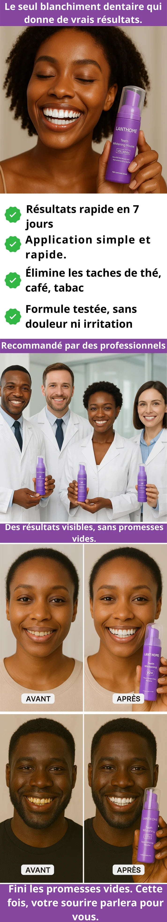 Mousse de blanchiment des dents Lanthome V34