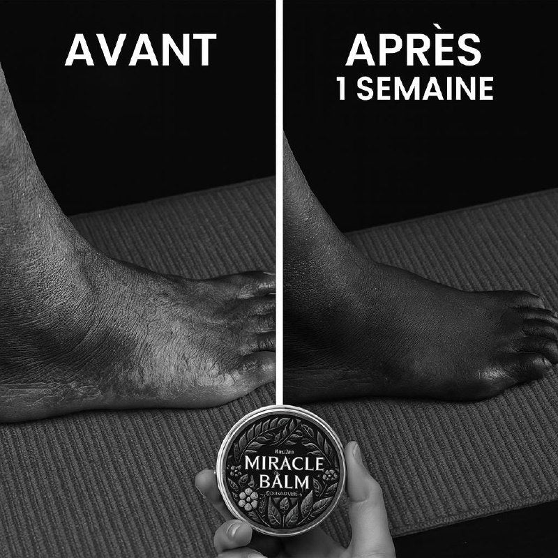 MIRACLE BALM – SOULAGE VARICES, JAMBES LOURDES, DOULEURS ET BRÛLURES AUX PIEDS, DOULEURS ARTICULAIRE, NEUROPATHIE DÈS LA PREMIÈRE APPLICATION